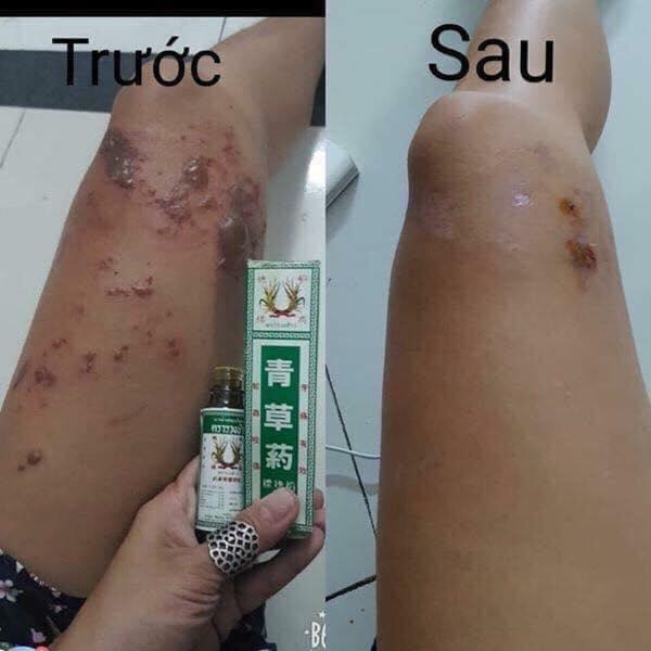 DẦU BÔNG LÚA MINYAK THÁI LAN