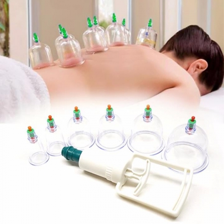 [HCM]BỘ DỤNG CỤ GIÁC HƠI -KHÔNG DÙNG LỬA - 12 Ống