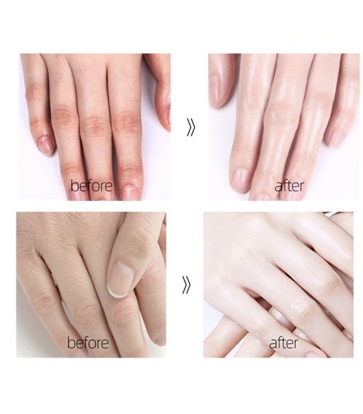 Tinh chất Dưỡng da tay Serum Yinba