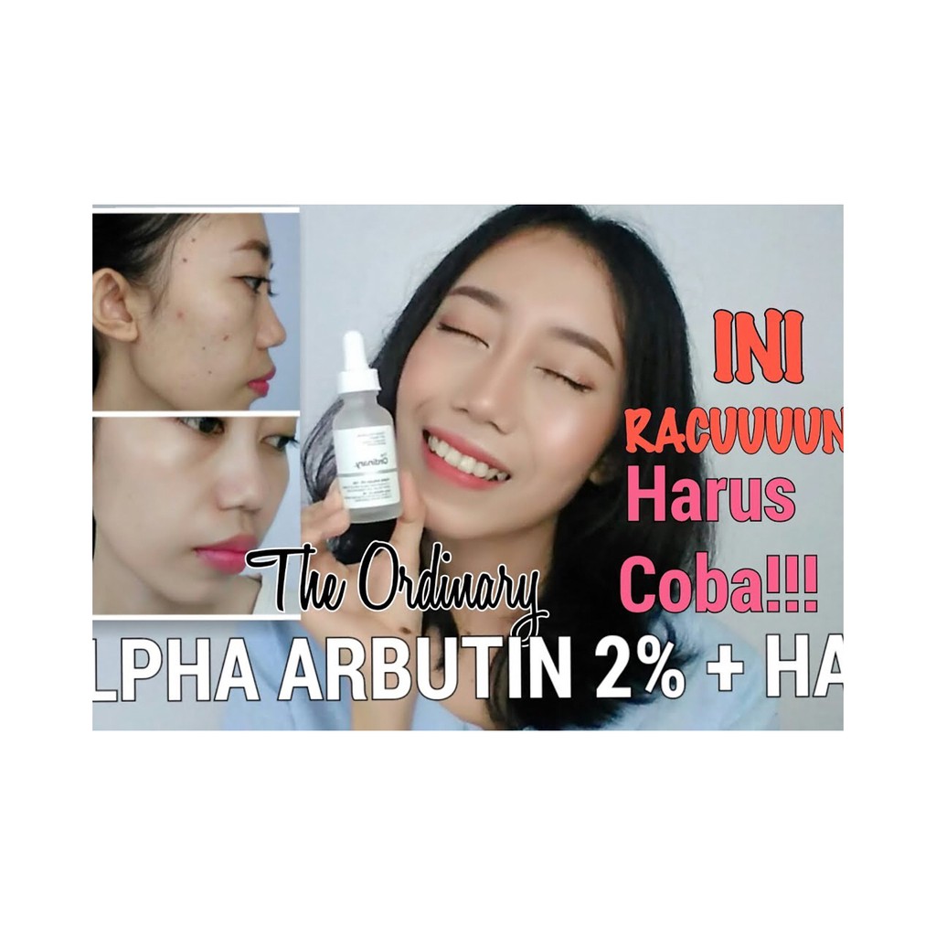 Serum odinary dưỡng trắng da ALPHA ARBUTIN 2% + HA 30ml