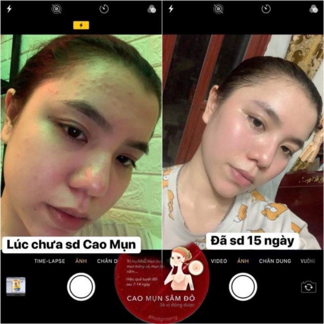 Cao mụn sâm vàng