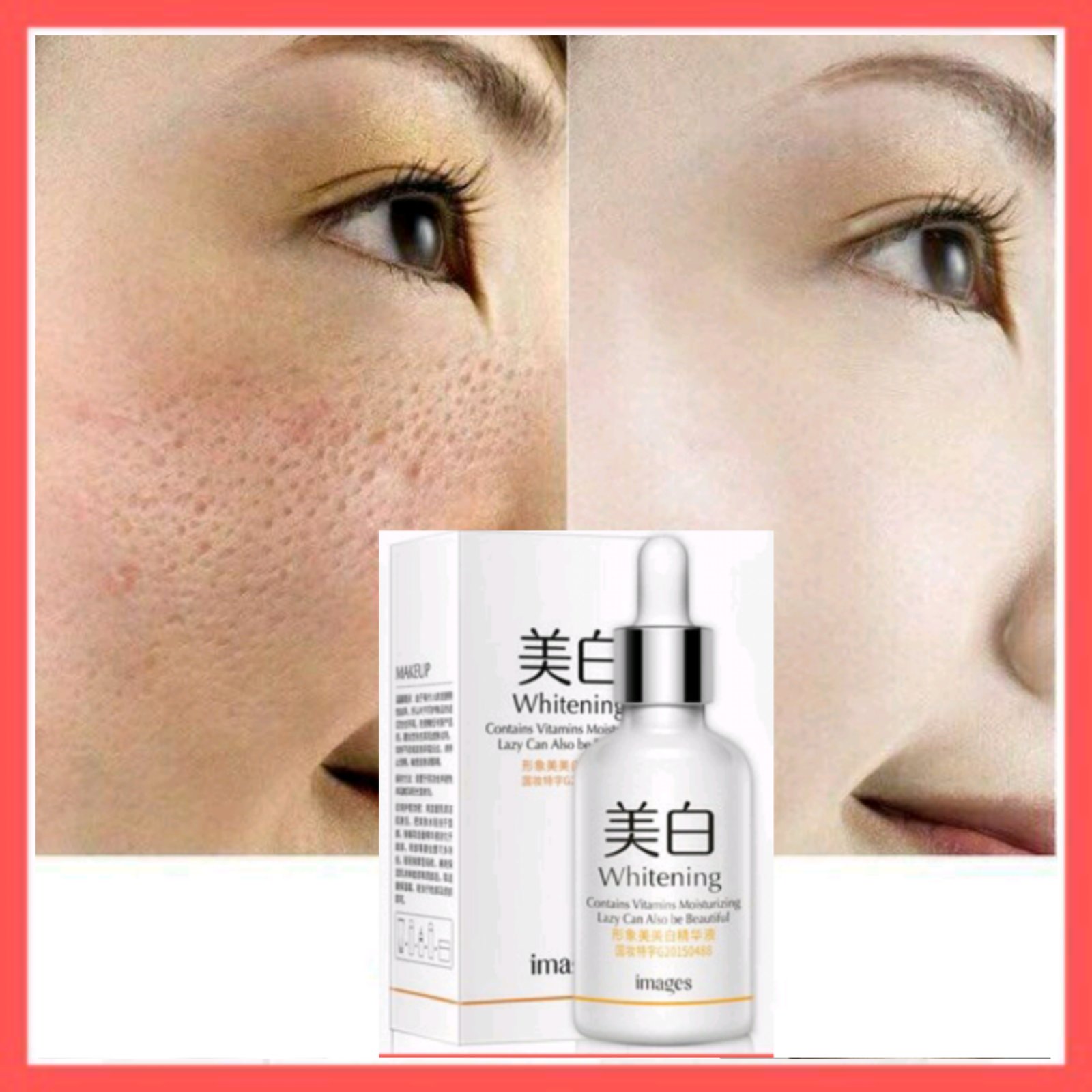 [HCM]SERUM XÓA SẸO RỔ SẸO MỤN