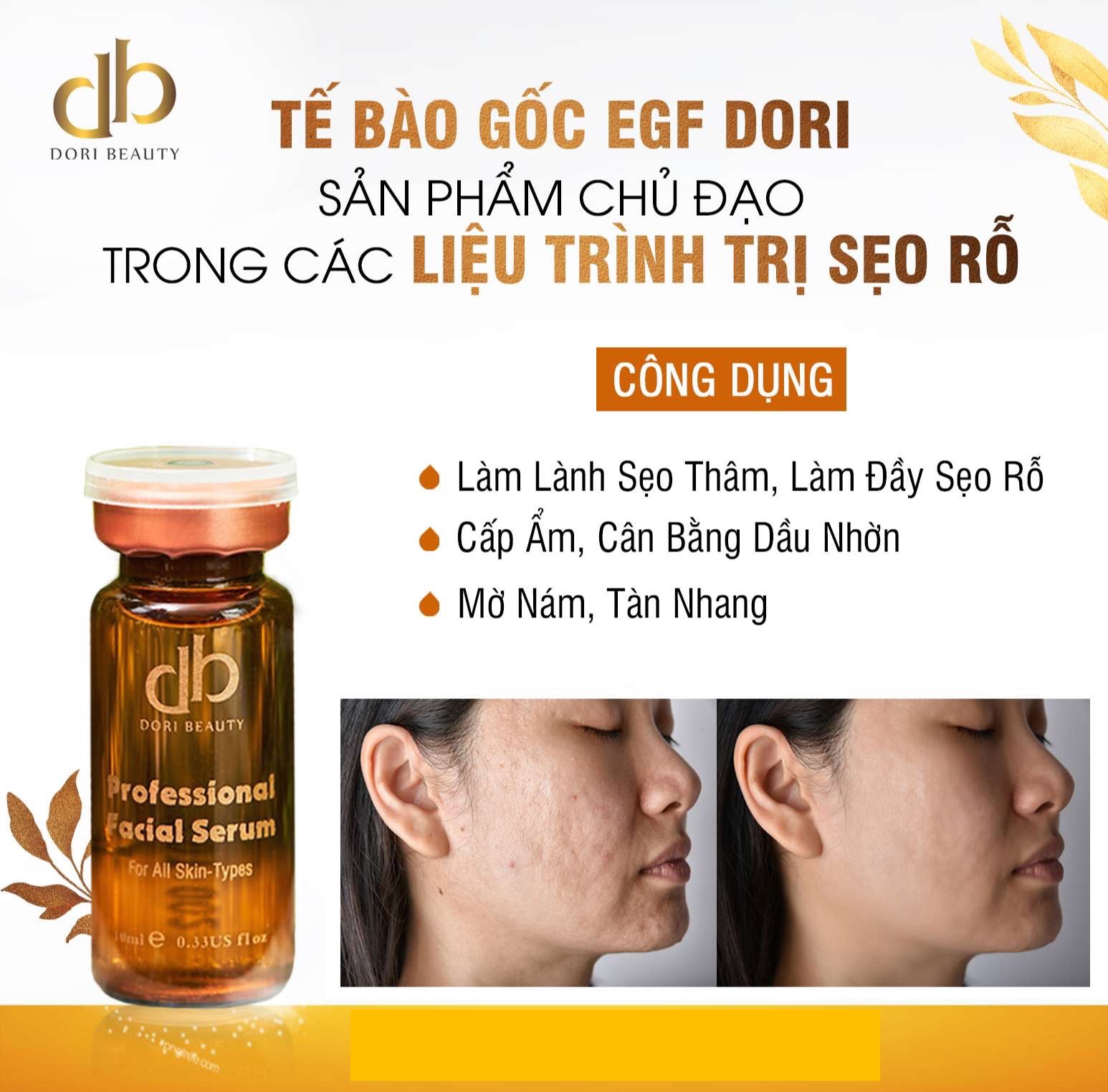 Serum Tế Bào Gốc EGF Dori