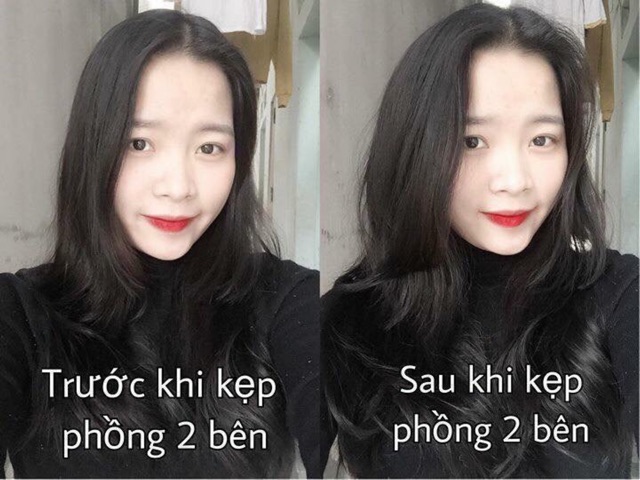 Kẹp Phím Phồng Làm Dày Tóc Sỉ 30K