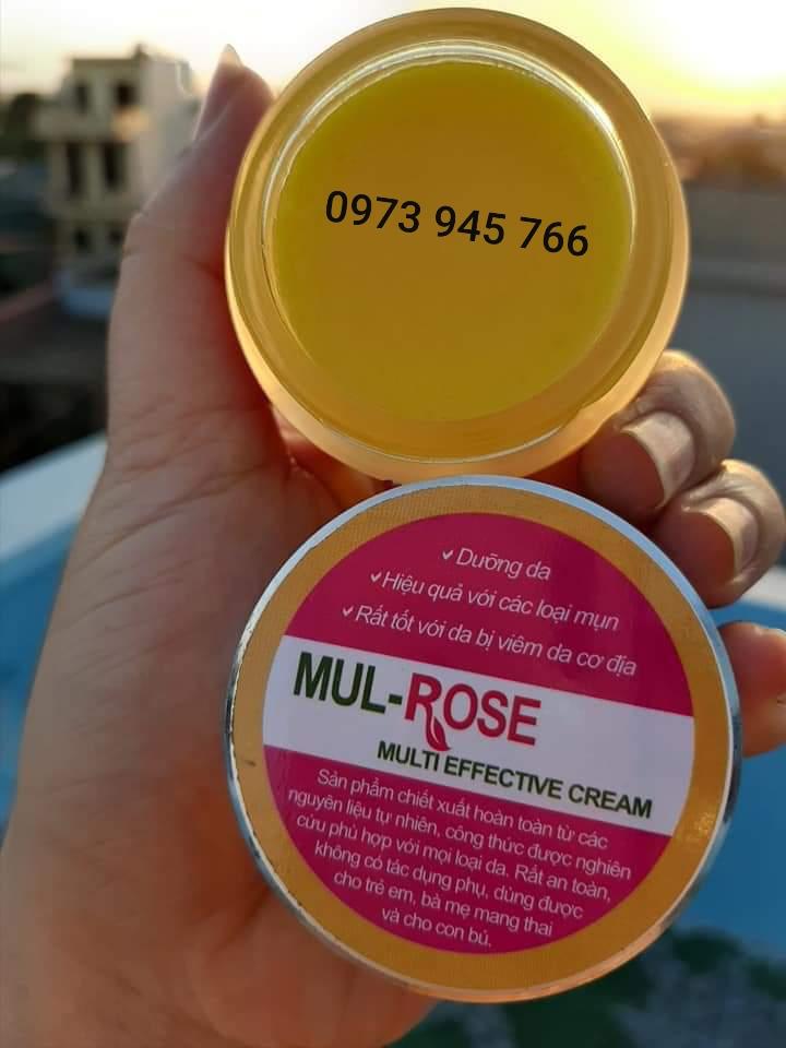 Kem ngừa mụn mul rose
