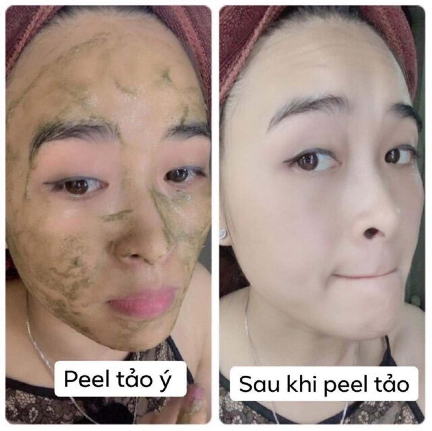 Peel Da vi tảo 7 ngày đẹp (1  bo)