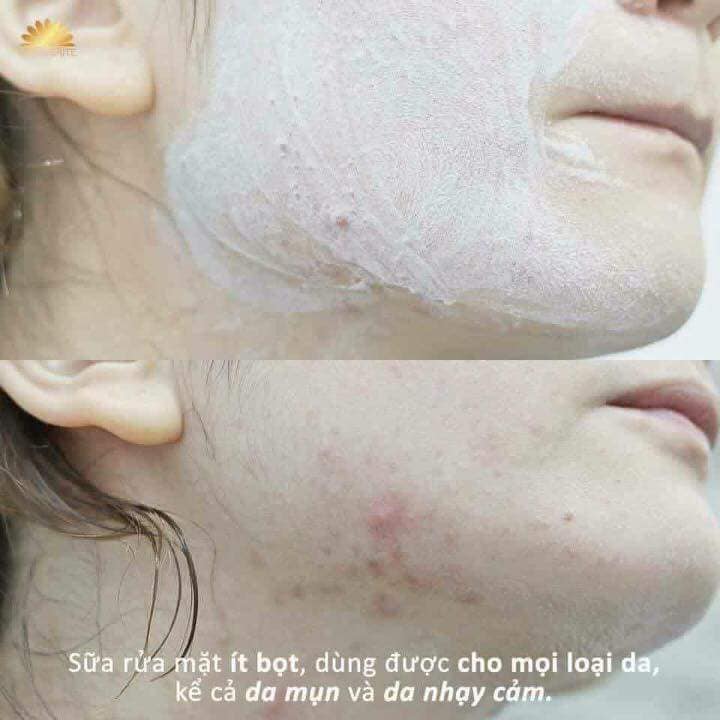 [ Mẫu Mới ] Sữa Rữa Mặt Kiềm Dầu Giảm Mụn Khoáng Núi Lửa 120g