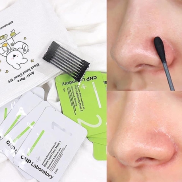 [HCM]Set Mặt Nạ Làm Sạch Mụn Đầu Đen CNP Blackhead Kit