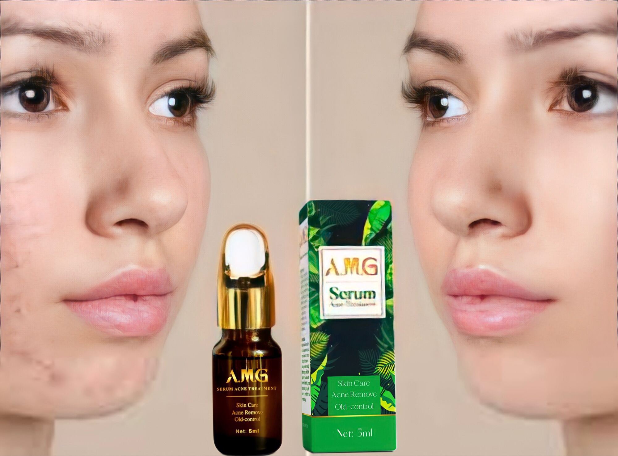 Serum mụn siêu tốc AGM 5ml