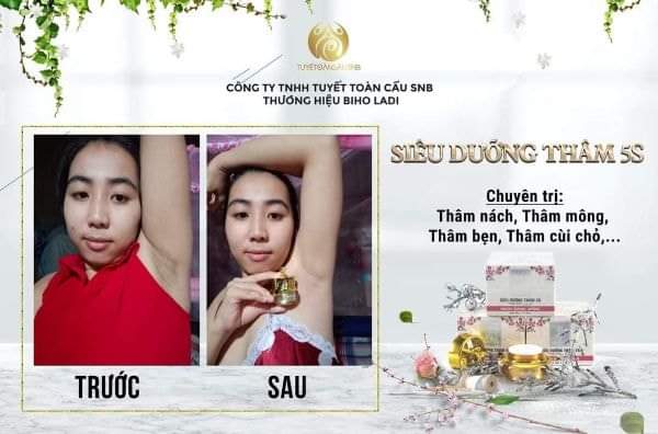Kem Biho Ladi 5s (Hàng Chính Hãng )