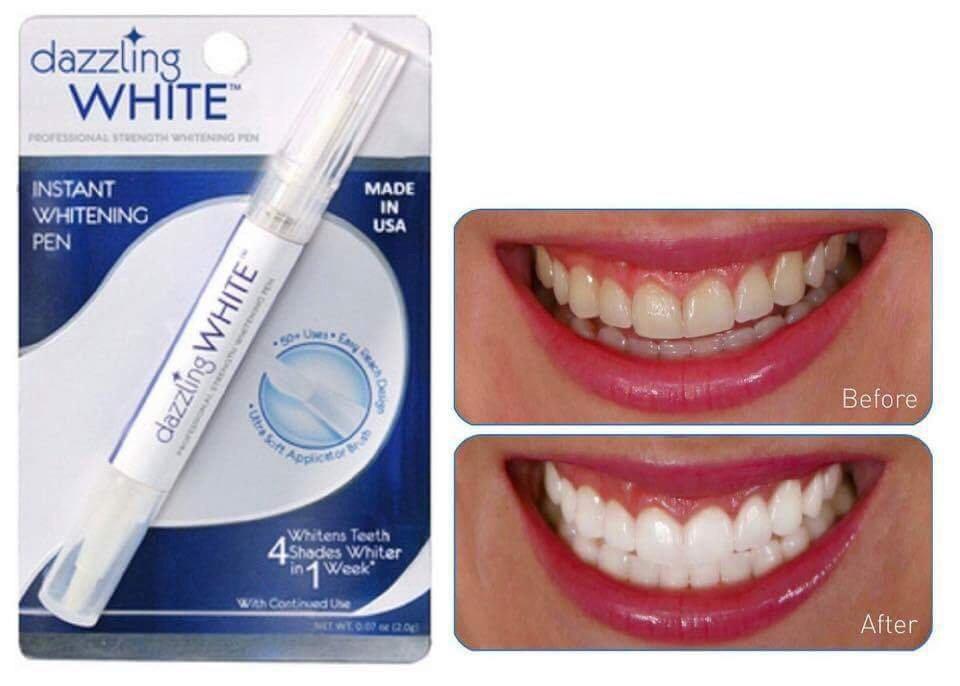 Combo 2 Bút tẩy trắng răng Dazzling White