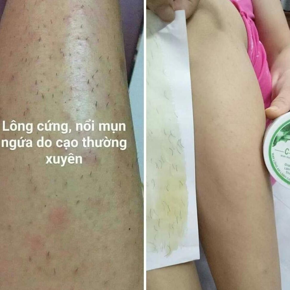 [HCM]wax lông tay chân nách An Lành