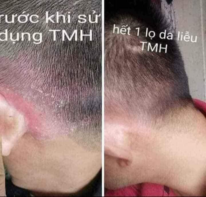 [HCM]Dầu Gội Thanh Mộc Hương