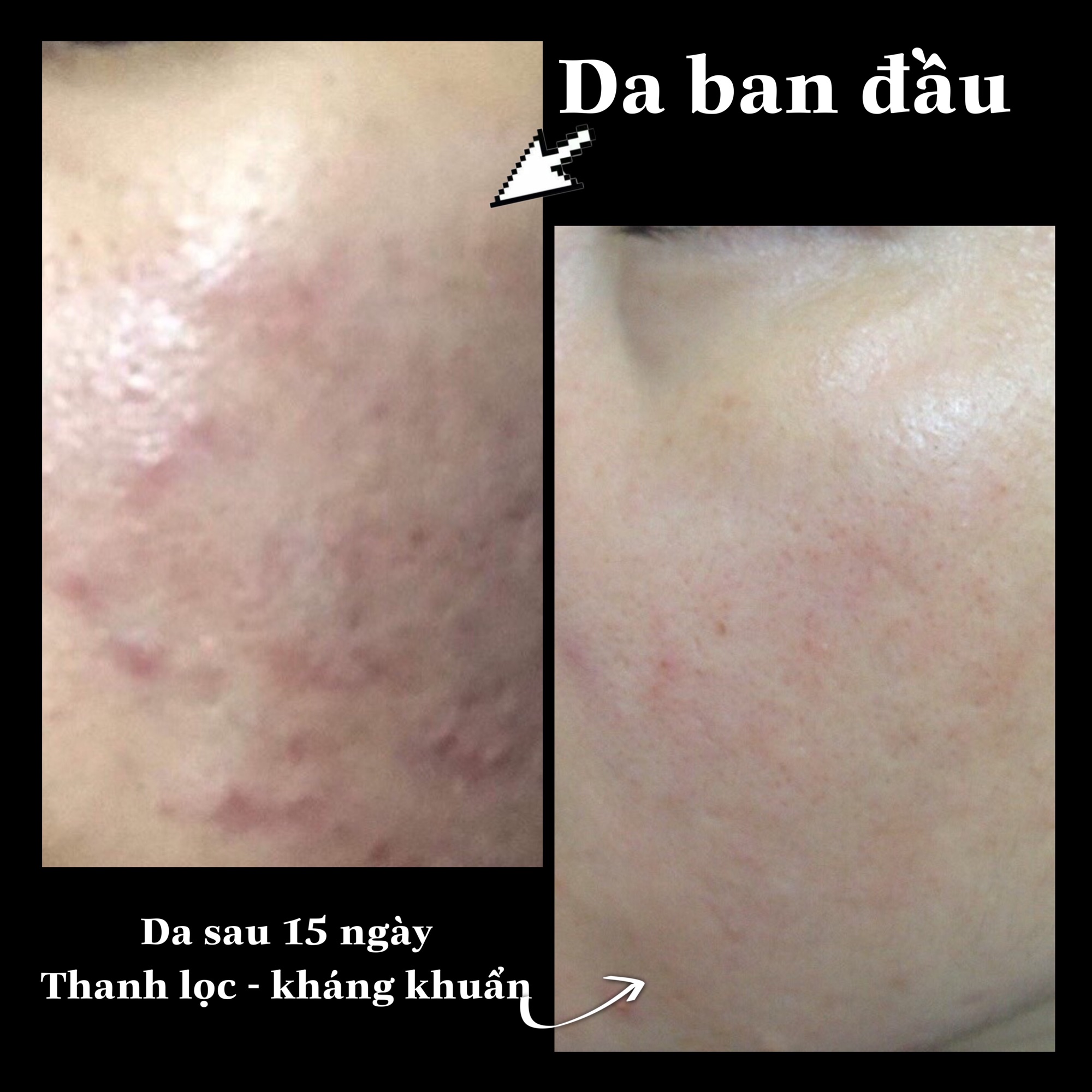 [HCM]1 Hộp tinh chất Peptide Đồng - phục hồi da