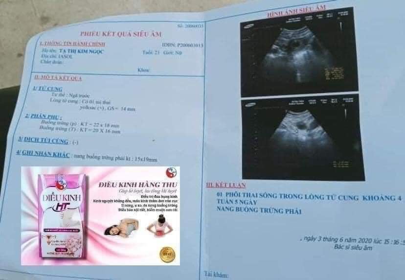 Điều Kinh Hằng Thu (Mẫu mới)