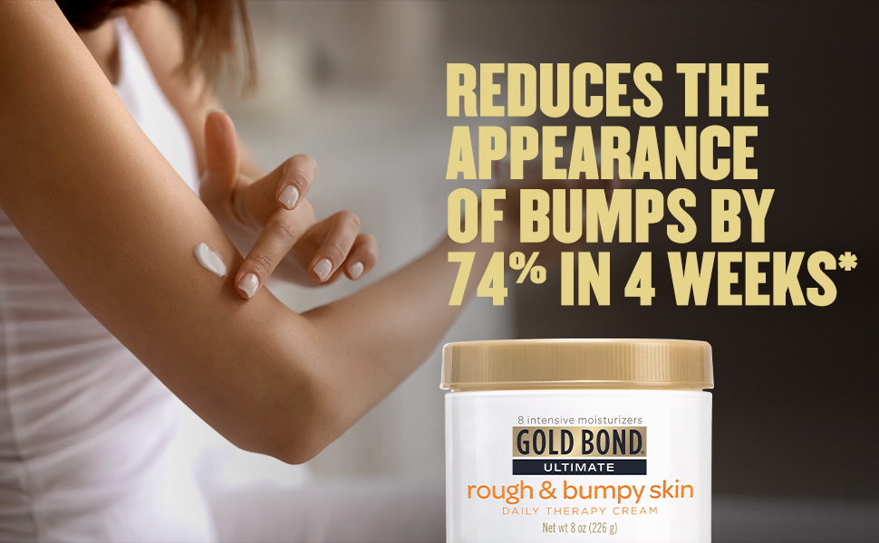 [HCM]BILL US - KEM DƯỠNG DA GOLD BOND ULTIMATE ROUGH &amp BUMPY SKIN 226G