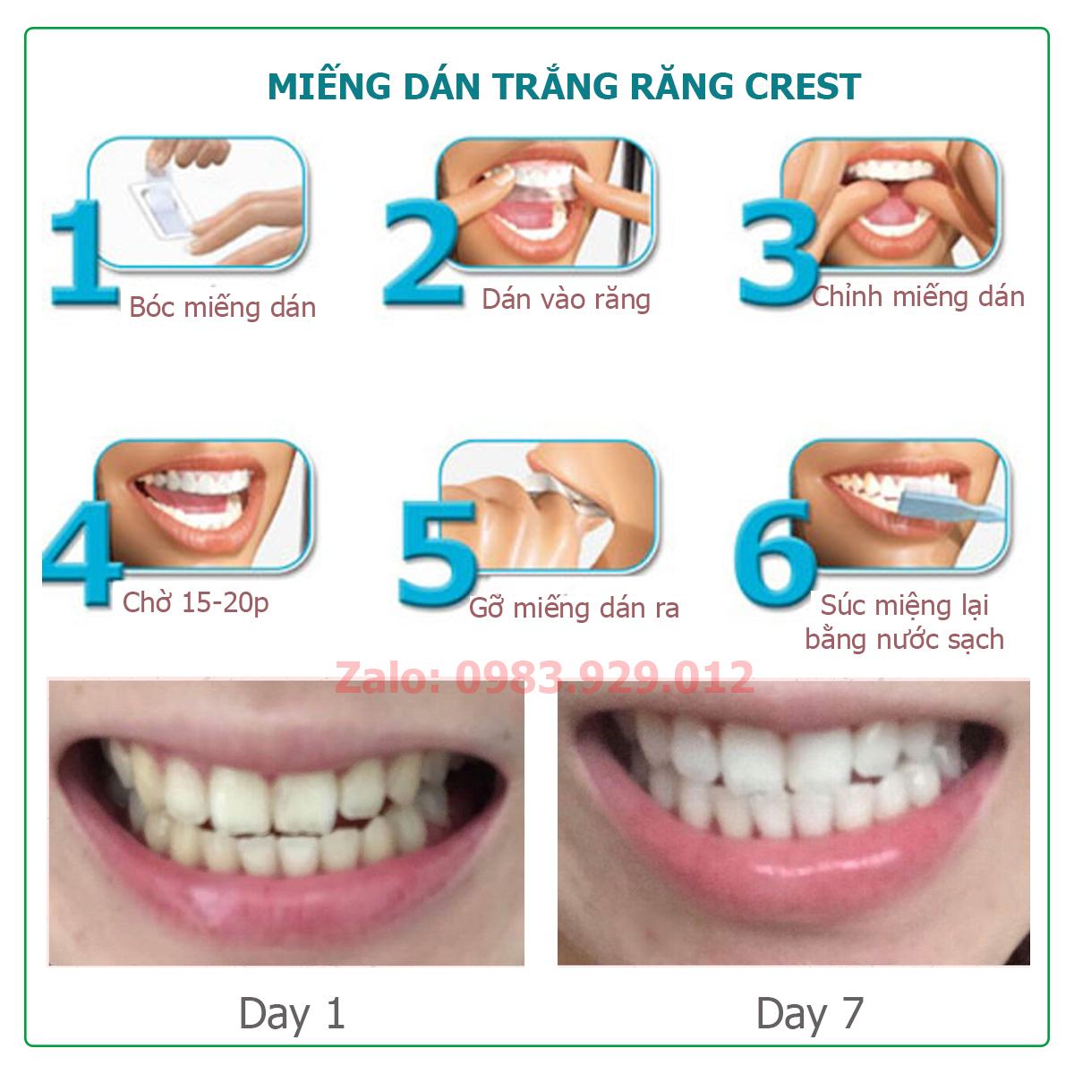 Miếng dán trắng răng Crest 3D White Professional Effects, 1 hour Express, Supreme Bright, Sensitive Bright, Vivid