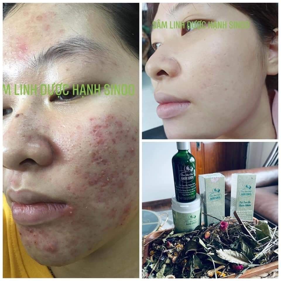 ĐÔNG Y HẠNH SINOO