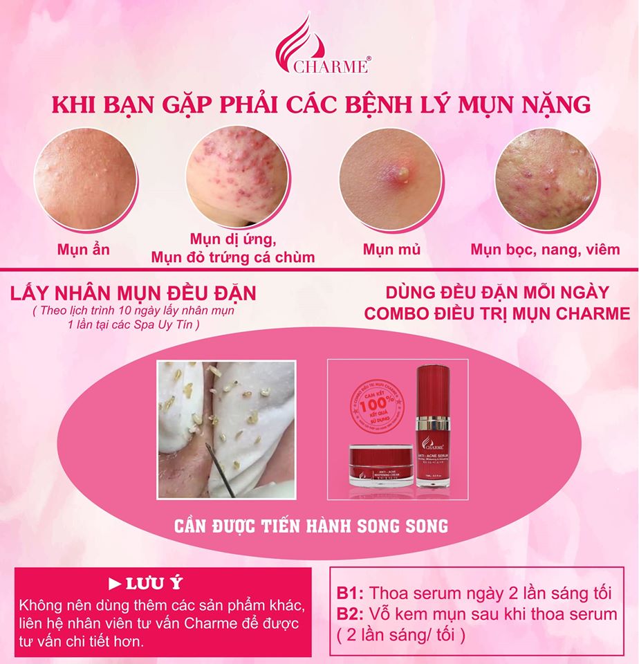 Serum Ngừa Mụn Trắng Da Charme_Hàn Quốc 15ml