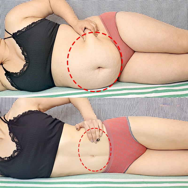 Nguyên chất Detox và miếng dán giảm cân Navel Stick Giảm cân đốt cháy mỡ thừa. Trung y dán rốn dán bụng thon dán giảm cân sản phẩm giảm cân Miếng dán giảm cân nâng cấp phiên bản mới (10PCS)