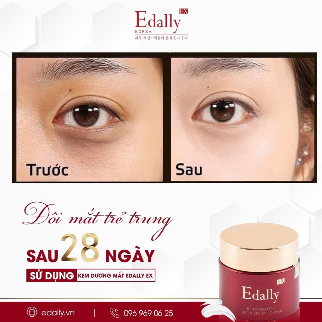 [CHÍNH HÃNG] Kem dưỡng mắt Edally.