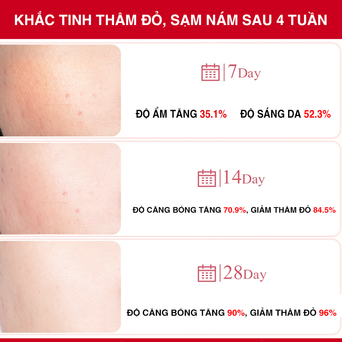 Tinh Chất Xoá Thâm Đỏ Mờ Sạm Nám Angel's Liquid Tranexamic Mela Ampoule 30ml