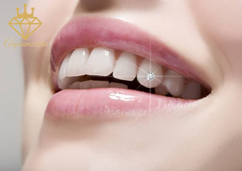 Kim cương nhân tạo gắn răng chân nhọn (Moissanite cao cấp)
