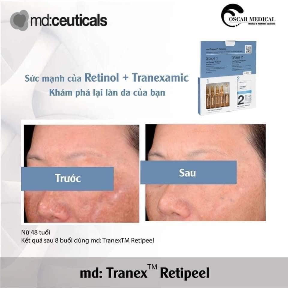 [Nhập khẩu] Set nám, làm trắng và chống lão hóa da Md Tranex Retipeel Whitening & Antiage Solution và Mặt nạ trẻ hóa da Md Tranex Retipeel Sealing Yellow Mask