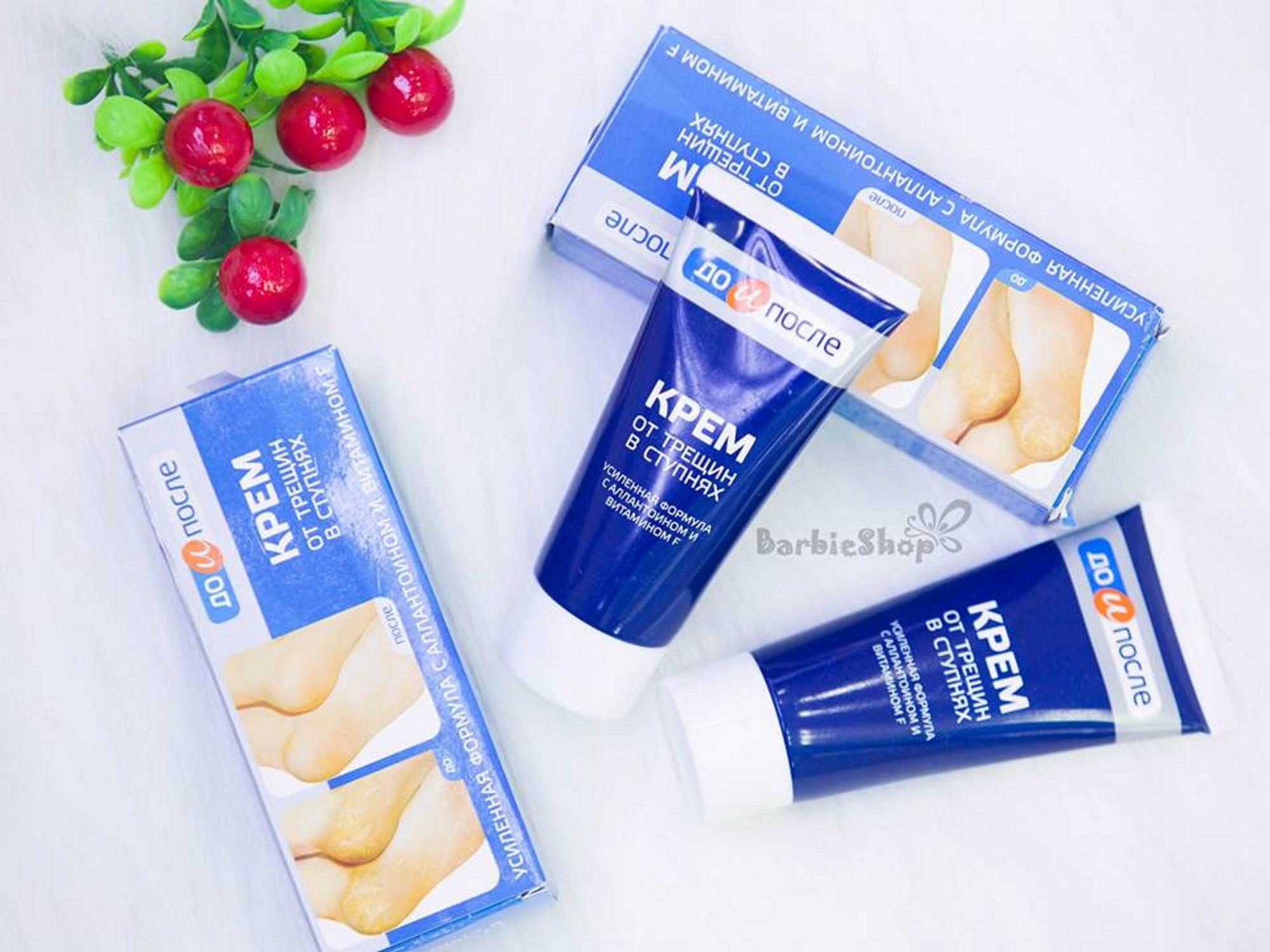 Kem Trị Nứt Gót Chân Kpem Apteka Nga