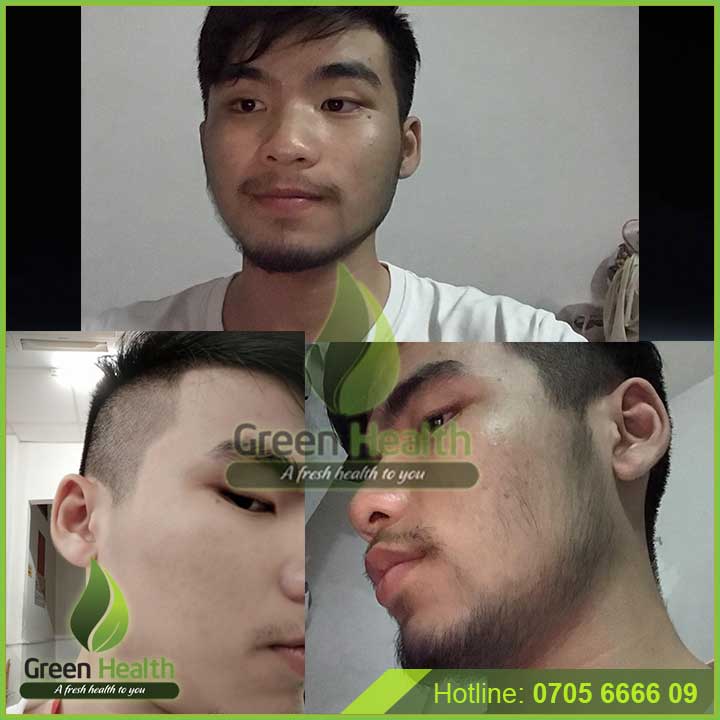 KIM LĂN TAY ZGTS VÀNG 0.5mm