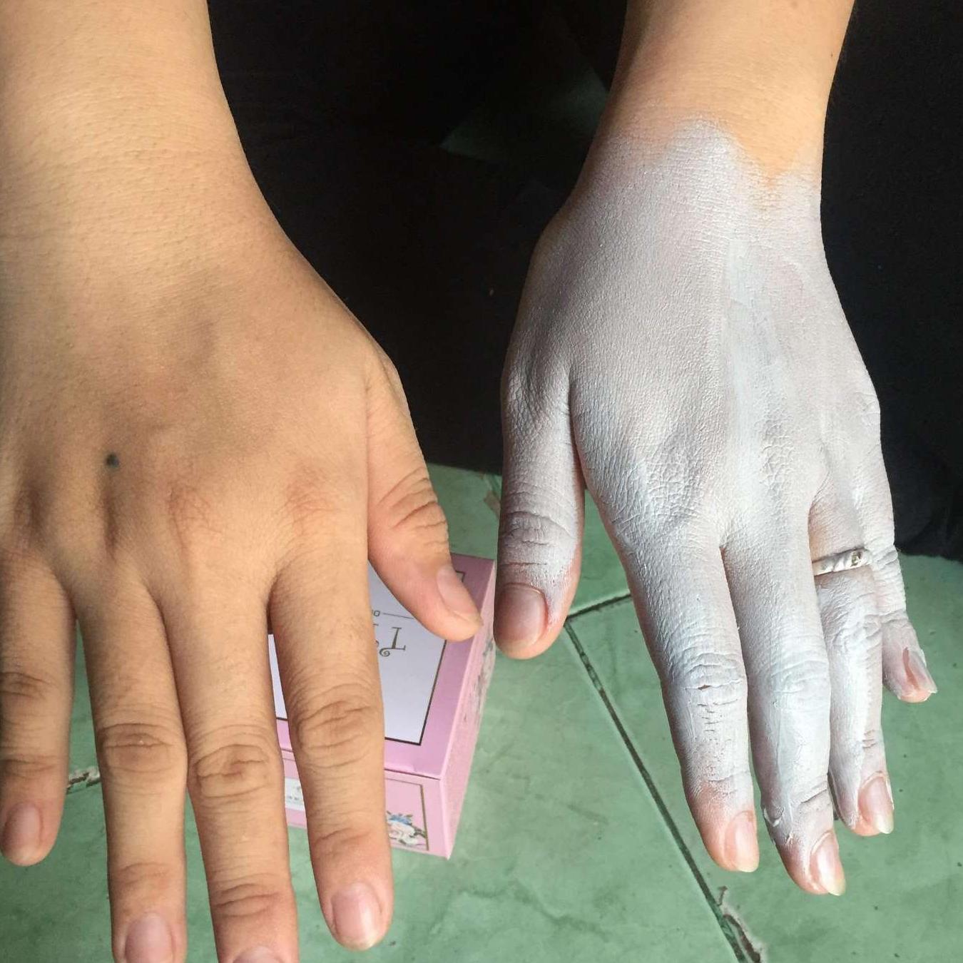 Ủ Trắng Dâu Tằm