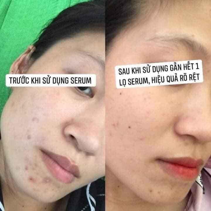 COMBO SHINA SKIN