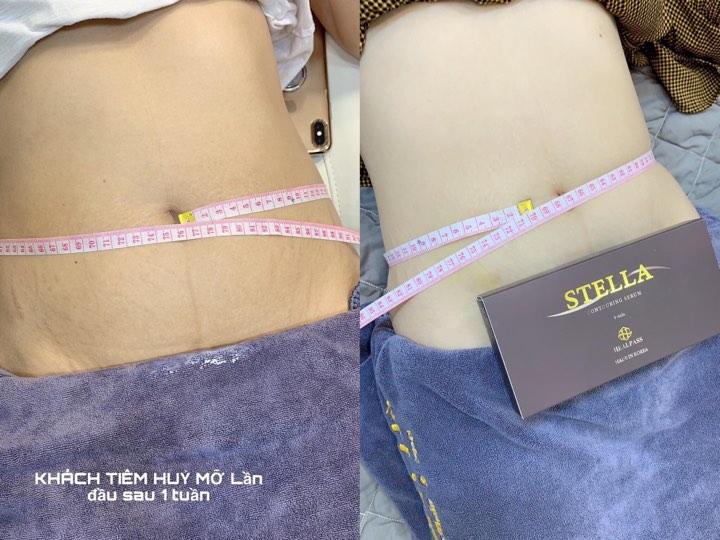 [HCM]STELLA TAN MỠ VIP CHUẨN HÀN