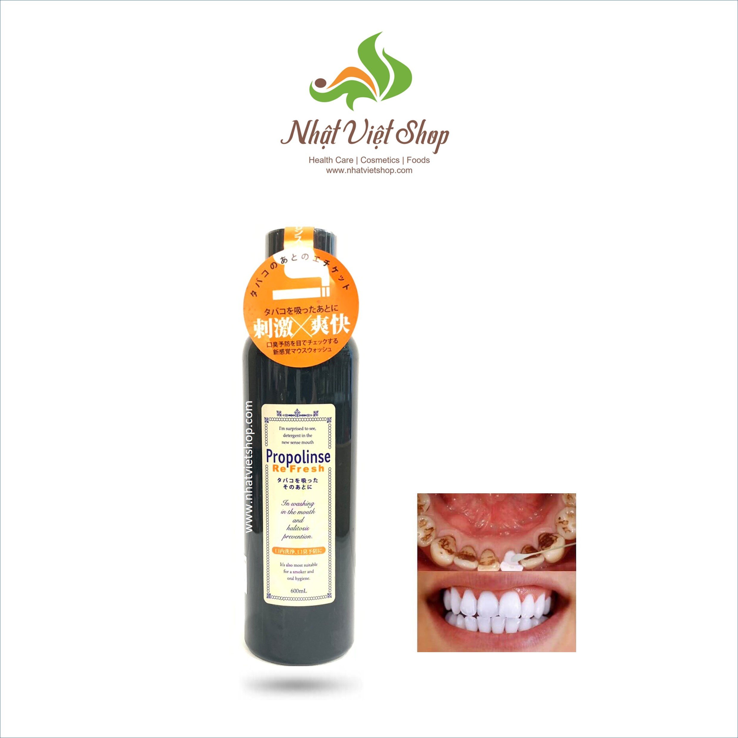 Nước xúc miệng Nhật Bản Propolinse 600ml