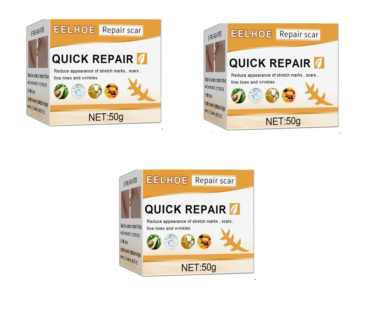 Kem xóa sẹo lâu năm phẫu thuật dưỡng trắng da quick repair scar 50g - nhập khẩu usa