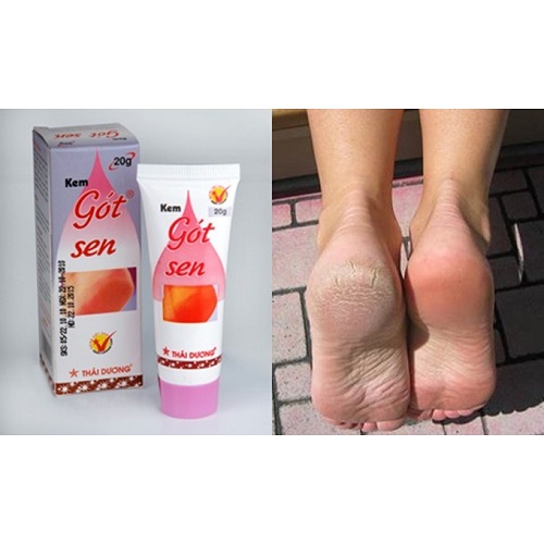 Gót Sen ngừa nứt nẻ gót chân