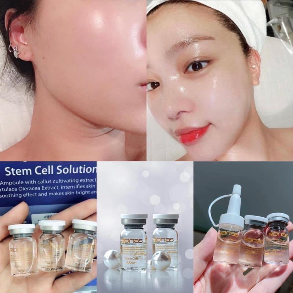 Tinh Chất Tế Bào Gốc Ronas Stem Cell Solution Phục Hồi Trắng Sáng Da