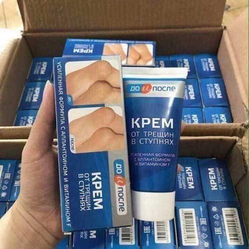 Kem giảm nứt gót chân Nga