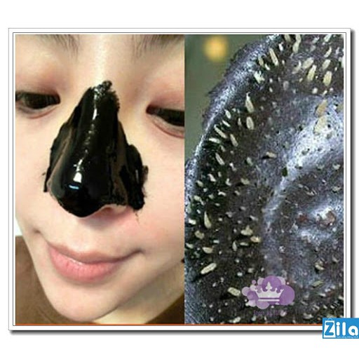 Gel lột mụn hút mụn than tre