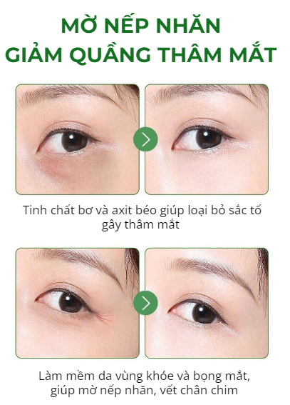 Kem  bơ giảm mụn thịt Yaquinuo nội địa Trung