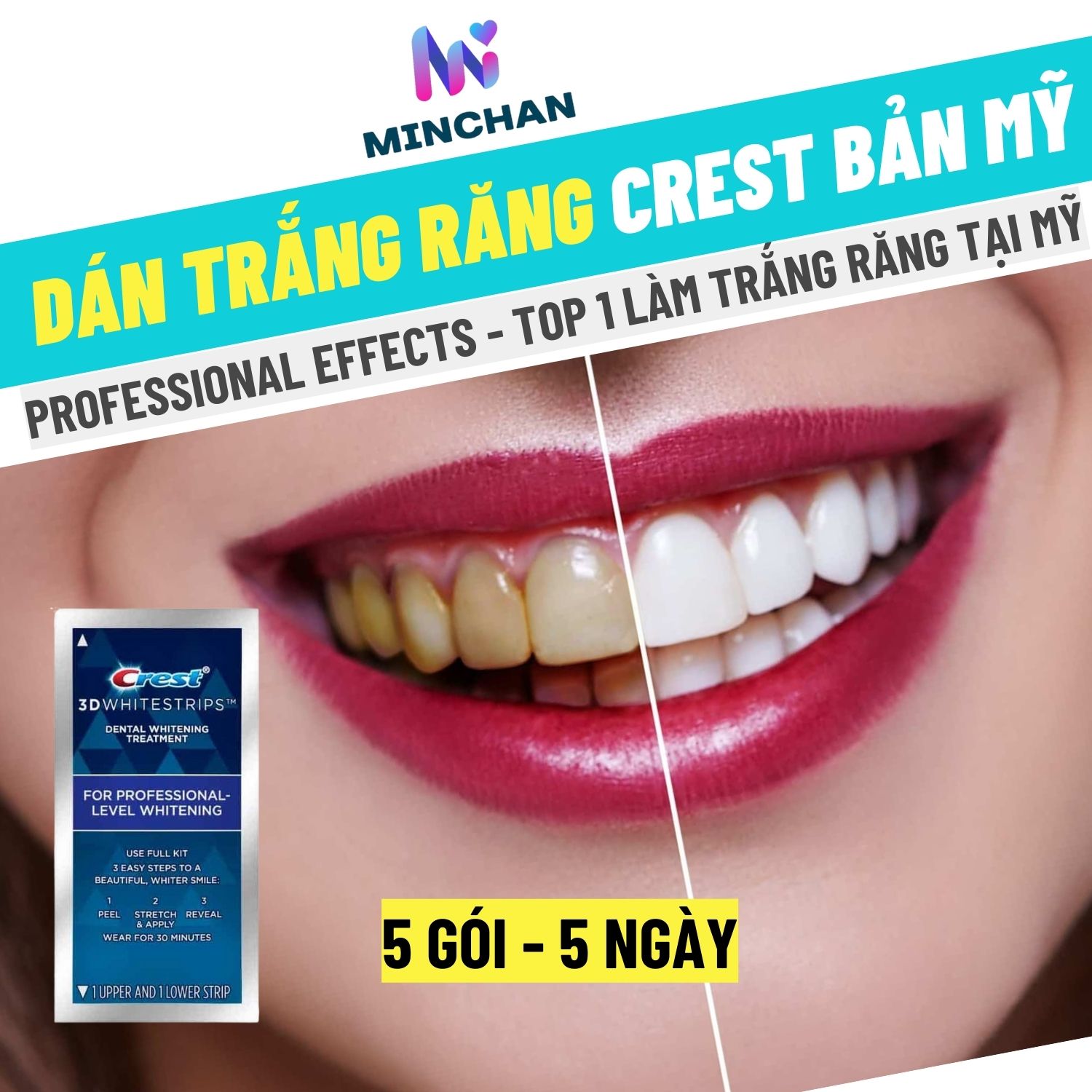 [Hàng Mỹ] Combo 10 miếng (5 gói/5 ngày) dán trắng răng Crest 3D White Whitestrips Professional Effects (mẫu mới 2023)