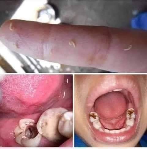Sâu răng,hôi miêng Trần Kim Huyền