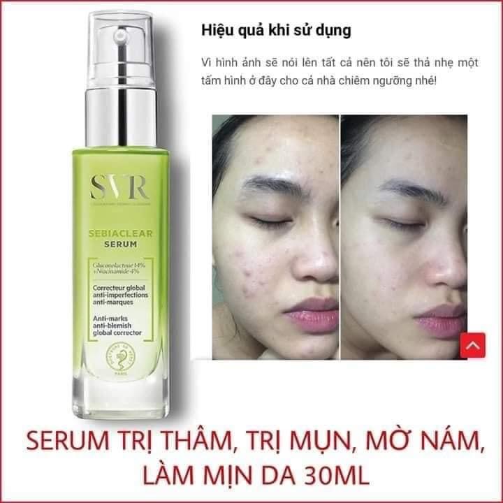 [ Mẫu mới ] Serum SVR SEBIACLEAR 30ml