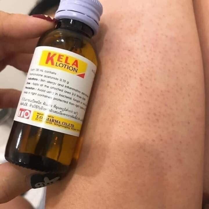 KELA LOTION Bôi Viêm Lỗ Chân Lông Thái Lan