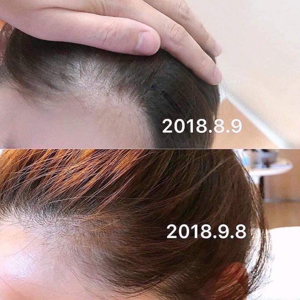 Tinh chất kích thích mọc tóc Sato Nhật Bản