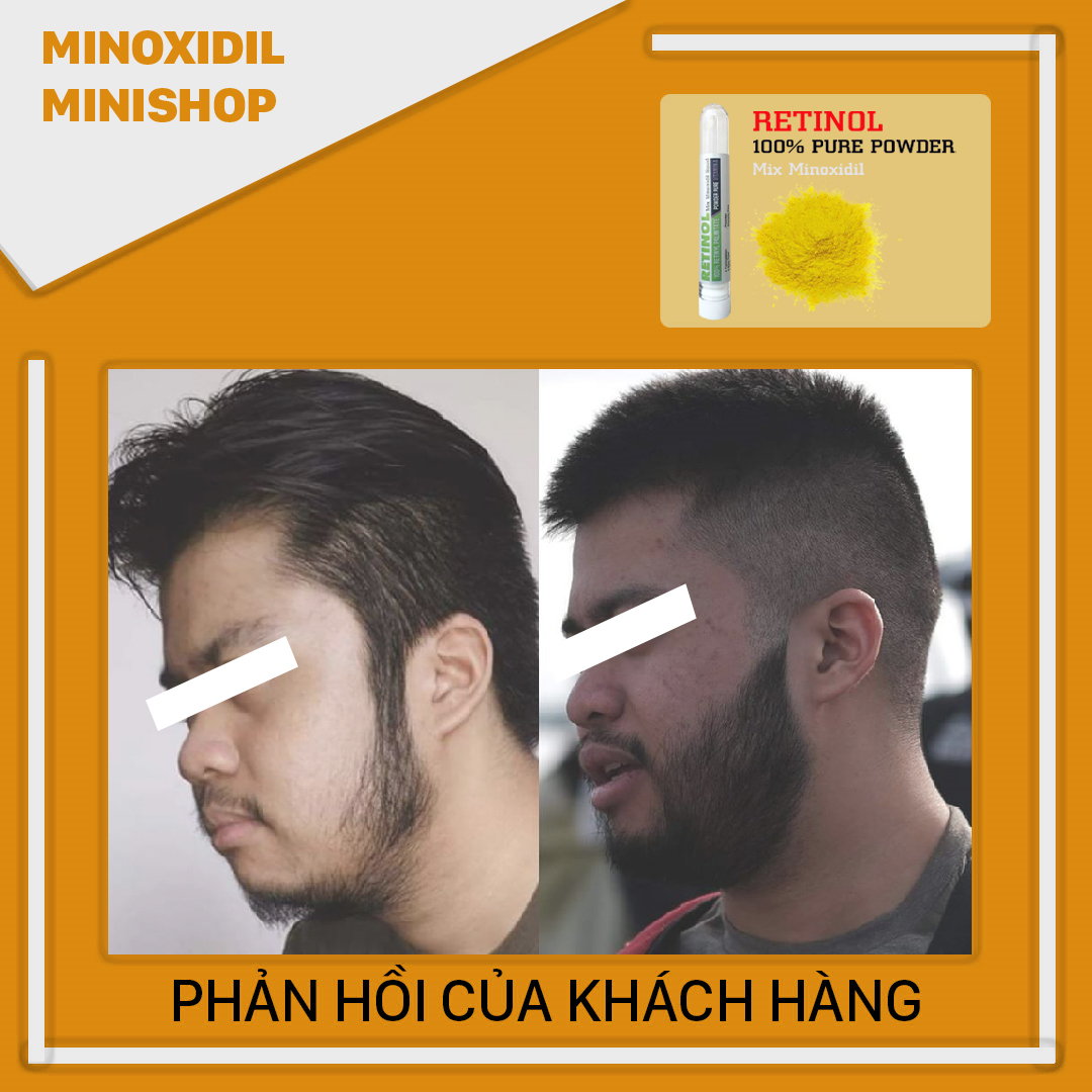 Retinol Giúp Mọc Râu Nhanh