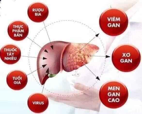 [HCM]Bổ Gan Cao Cấp Kwangdong Hàn Quốc(Hộp to 120 viên)