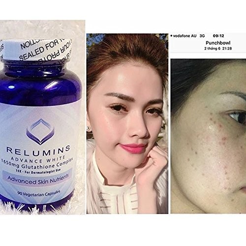VIÊN UỐNG TRẮNG DA RELUMINS ADVANCE WHITE 1650MG GLUTHATIONE COMPLEX 90 VIÊN - 2487