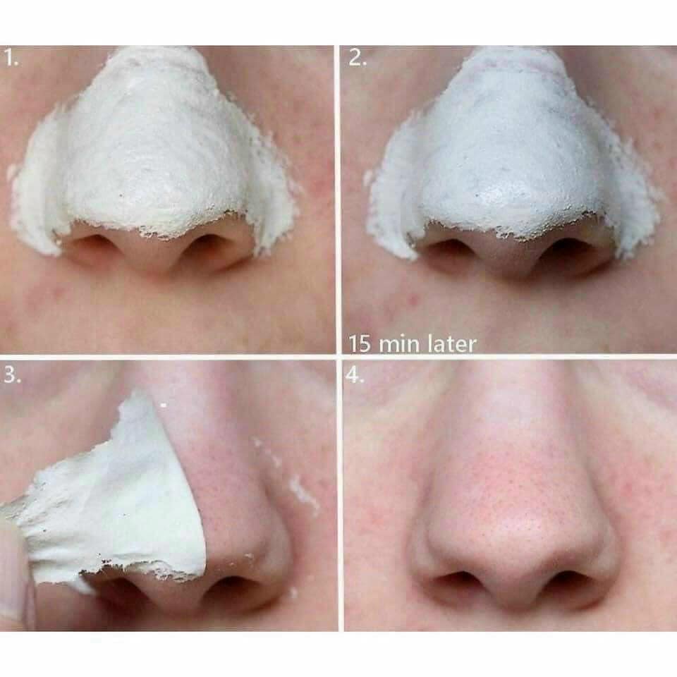 [ MẪU MỚI NH.AAT ] 💕Gel Lột Mụn 💕 Đầu Đen 𝐉𝐞𝐣𝐮 𝐕𝐨𝐥𝐜𝐚𝐧𝐢𝐜 𝐋𝐚𝐯𝐚 New 2020