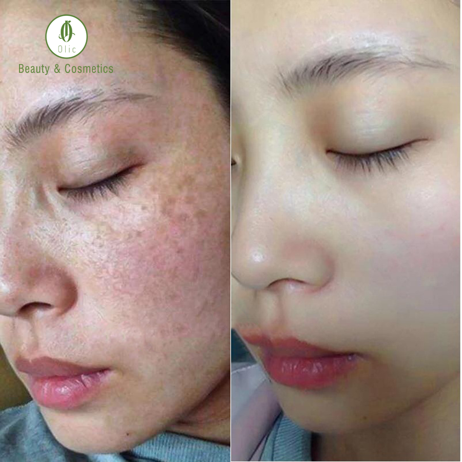 SÂM ĐẾ VƯƠNG OLIC (MỸ PHẨM CHÍNH HÃNG)